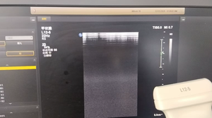 Servicio de Reparación de Sonda de Ultrasonido L12-5, Máquina de Ultrasonido L12 5 - Product Image 1