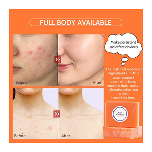 Hữu cơ tốt nhất âm đạo làm trắng làm sạch xà phòng làm bằng tay Probiotic PH cân bằng ngứa cứu trợ Yoni Thanh xà phòng cá nhân bọc 4. - Product Image 6