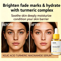 Sérum professionnel à l'acide kojique, au curcuma et à la niacinamide, éclaircissant doux pour les taches, les marques d'acné, unifiant le teint, anti-âge, soin de la peau