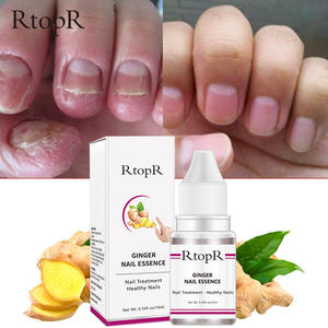 Venta al por mayor 10ml RTOPR <span class=keywords><strong>Natural</strong></span> Herbal Fungal <span class=keywords><strong>Nail</strong></span> Repair Serum Ginger Hand Foot <span class=keywords><strong>Nail</strong></span> <span class=keywords><strong>Treatment</strong></span> - Product Image 5
