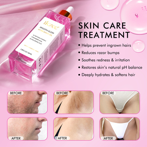 IKZEE Huile Après-Rasage Éclat Lissant 100 ml pour <span class=keywords><strong>Femme</strong></span>, Prévient les Poils Incarnés, Hydratation Intense et Lissage de la Peau - Product Image 3
