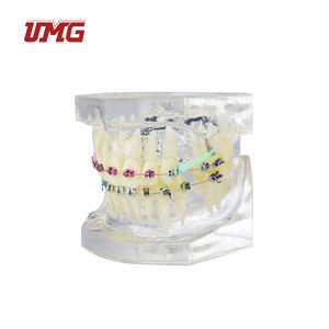 Modelo <span class=keywords><strong>de</strong></span> ortodoncia para entrenamiento Dental, modelo tipodot con soporte <span class=keywords><strong>de</strong></span> Metal transparente para la comunicación <span class=keywords><strong>de</strong></span> los pacientes - Product Image 2