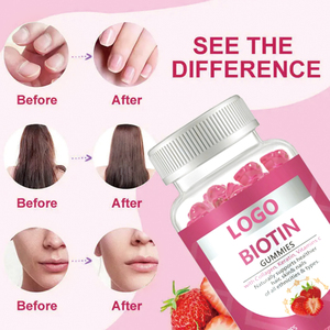 علامة تجارية خاصة بنكهة تبييض البشرة نمو الشعر البيوتين الكولاجين مكمل الكيراتين الدببة اللهائية فيتامين للشعر والبشرة والأظافر - Product Image 4