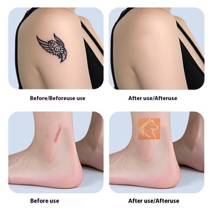 Autocollant de couverture de tatouage réutilisable, imperméable, résistant à la transpiration, cache-cicatrices, patch corporel fin et invisible pour la protection de la peau - Product Image 1