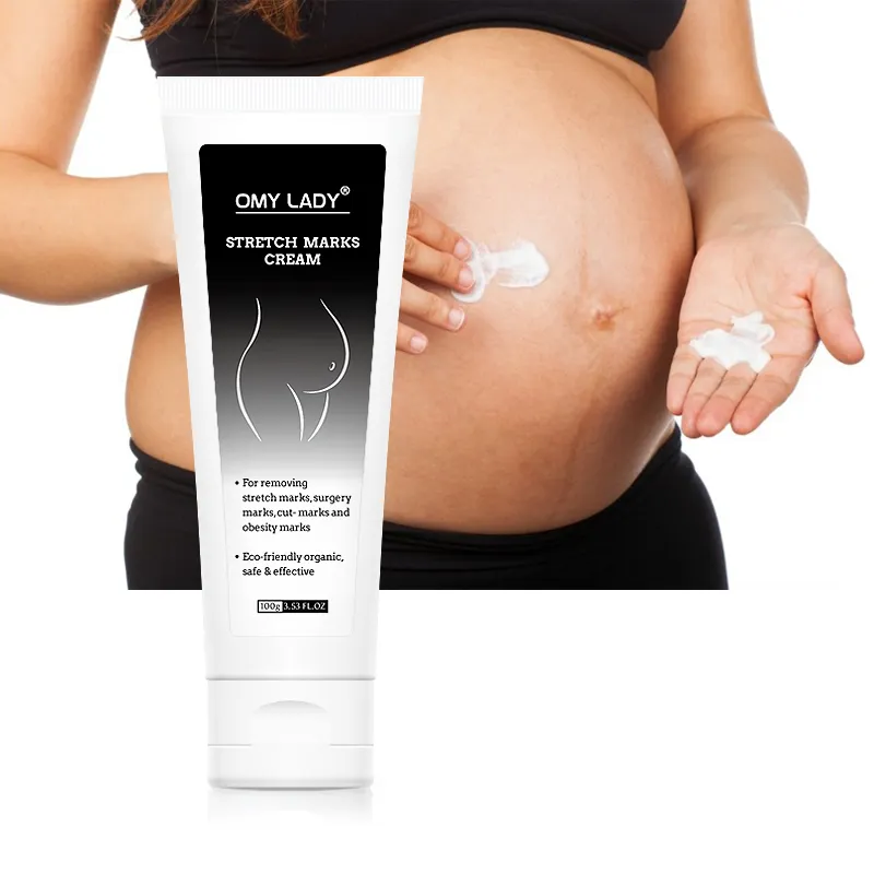 OMY LADY remove scar belly cream per prodotti per la cura materna prodotti anti smagliature