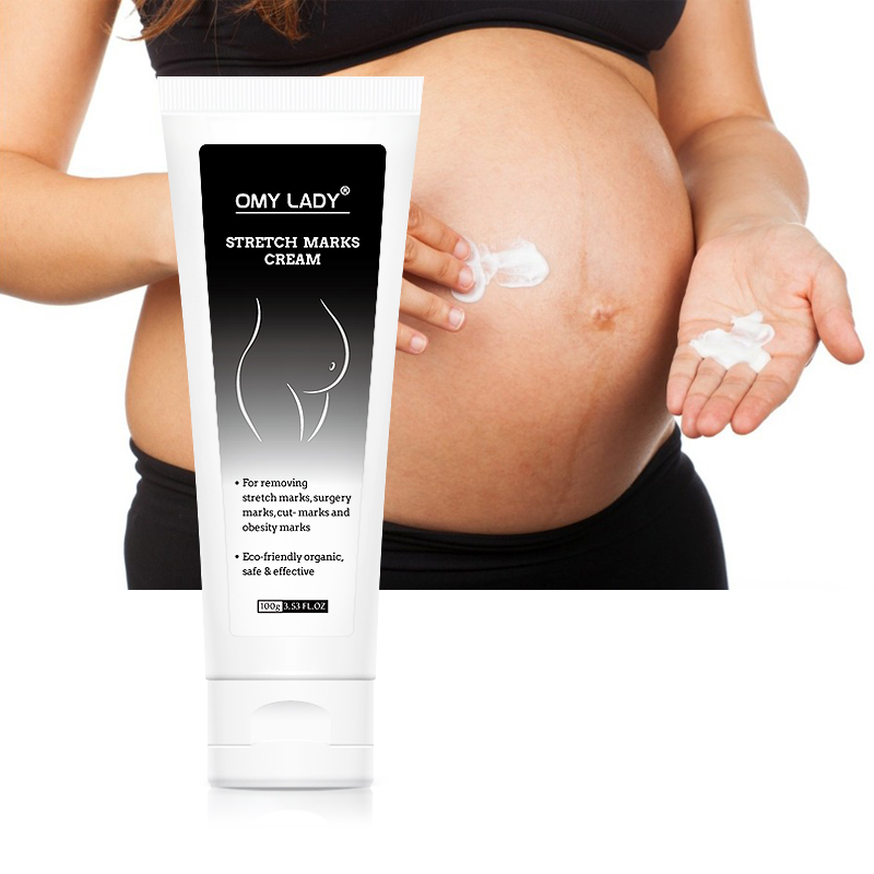 OMY LADY entfernen Narben bauch creme für Maternal Care Produkte Anti Stretch Marks Produkte