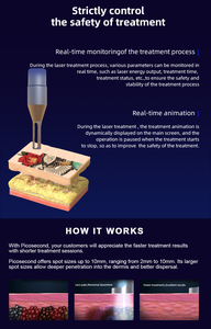เครื่องเลเซอร์ทางการแพทย์แบบ <span class=keywords><strong>Q</strong></span>-Switch Nd:YAG อุปกรณ์เลเซอร์ความงาม กระชับผิว เลเซอร์พิโกวินาที อุปกรณ์ลบรอยสักบนใบหน้า - Product Image 6