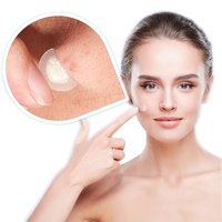 <strong>Best</strong> Seller Custom Microneedle <strong>Acne</strong> <strong>Patch</strong> <strong>Hydrocolloid</strong> <strong>Acne</strong> Spot Pimple Master <strong>Patch</strong> Clear Microneedle <strong>Acne</strong> <strong>Patch</strong>