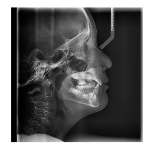 High Grade <strong>Dental</strong> Equipment Panorama Cephalometric Xray Unit <strong>X</strong>-<strong>Ray</strong> Machine <strong>OPG</strong> CBCT Panoramic <strong>Dental</strong> <strong>X</strong>-<strong>ray</strong> - Product Image 4