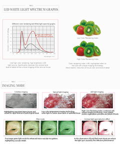 Caméra de colposcopie vidéo Kernel KN 2200 <span class=keywords><strong>pour</strong></span> capturer <span class=keywords><strong>des</strong></span> <span class=keywords><strong>images</strong></span> haute résolution destinées aux gynécologues <span class=keywords><strong>pour</strong></span> examiner le col de l'utérus et le vagin - Product Image 3