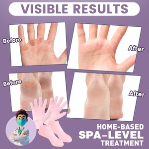 Ensemble de chaussettes en silicone pour gants hydratants, chaussettes antidérapantes en gel doux pour spa, adoucissant la peau sèche et craquelée des pieds - Product Image 2