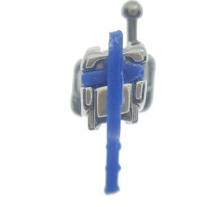 Consumabili odontoiatri coppia Standard 022 Ortodoncia passiva 3G staffa autolegante con CE ISO - Product Image 1