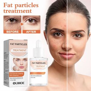 Sérum pour le visage OUHOE 30 ml, essence pour éclaircir la peau, traitement des éruptions cutanées, des papules et des pustules, blanchiment du millet - Product Image 1