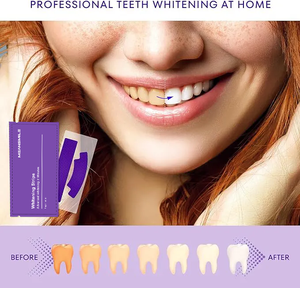 Bandes blanchissantes pour les <span class=keywords><strong>dents</strong></span> Meansmile, bio, véganes, violettes, <span class=keywords><strong>blanches</strong></span>, résistantes, de qualité supérieure, 14 paires, marque privée - Product Image 5