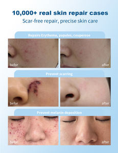 Pele do reparo após o tratamento do laser <span class=keywords><strong>Peel</strong></span> químico e outras intervenções da pele Tipo humanizado recombinante III soro do gel do colagénio - Product Image 2