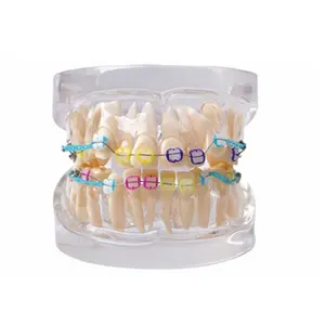 Dental Orthodontic Study Model Typodont Model with Ceramic Brackets