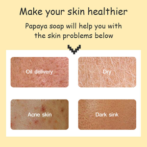 Jabón <span class=keywords><strong>de</strong></span> Papaya Natural Orgánico, Jabón Vegano Hecho a Mano en Barra <span class=keywords><strong>para</strong></span> Rostro y Cuerpo, Hidratante, Blanqueador e Iluminador <span class=keywords><strong>de</strong></span> <span class=keywords><strong>la</strong></span> Piel, en Forma Sólida - Product Image 5