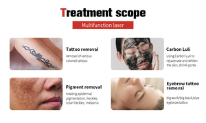 Máquina Láser de Picosegundos con Frecuencia Ajustable de 1-10Hz, con Carro, Modo Multi-Pulso, Eliminador de Cicatrices y Tatuajes para Salón Profesional - Product Image 5