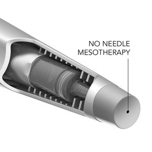 Equipo de Belleza para Mesoterapia sin Agujas, Instrumentos de Mesoterapia sin Agujas, Mesoterapia sin Agujas para Blanqueamiento de la Piel - Product Image 4