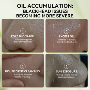 <span class=keywords><strong>Lanbena</strong></span>, recién llegado, removedor de espinillas, poros, suero retráctil y tiras de poros de la nariz, conjunto para el cuidado de la piel - Product Image 3