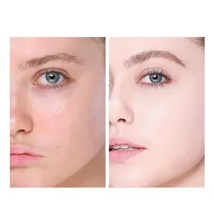 Crème à l'escargot tout-en-un avancée, répare et apaise les peaux rouges sensibilisées, crème hydratante pour le visage à la mucine d'escargot - Product Image 5