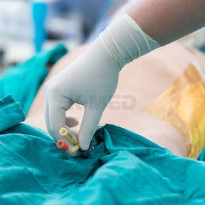 Catéter Foley de látex de consumibles para hospitales, Catéter urinario médico desechable, catéter Foley de 2 vías para pacientes - Product Image 5