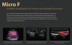 <span class=keywords><strong>Sonoscape</strong></span> P Serie P9/P10/P15/P20/P40/P50/P60 Trolley Kleur Doppler Systeem Echografie Machine - Product Image 3