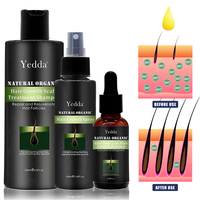 Esensi Penumbuh Rambut Universal untuk Pria dan Wanita. Produk Perawatan Rambut Anti-Rontok Herbal Organik yang Menutrisi.