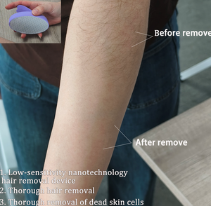 Nueva Tecnología, Herramienta para Eliminar Callos sin Dolor y de Baja Sensibilidad, Nanotecnología, Depilación Física con Nanocristales para <span class=keywords><strong>el</strong></span> Cuidado Corporal - Product Image 1