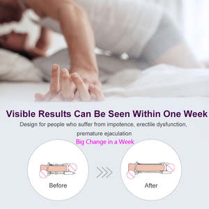 เครื่องยืดแบบหนีบขยายอวัยวะเพศชายโลหะสีดำอุปกรณ์ดึงสำหรับผู้ชายอวัยวะเพศชาย - Product Image 5