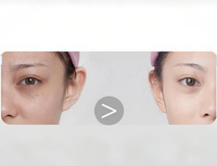 Aspiration Pore Hydratant Essence Du Visage Anti-oxydation Éclaircissant Réparation Niacinamide Vitamine C Essence Oem