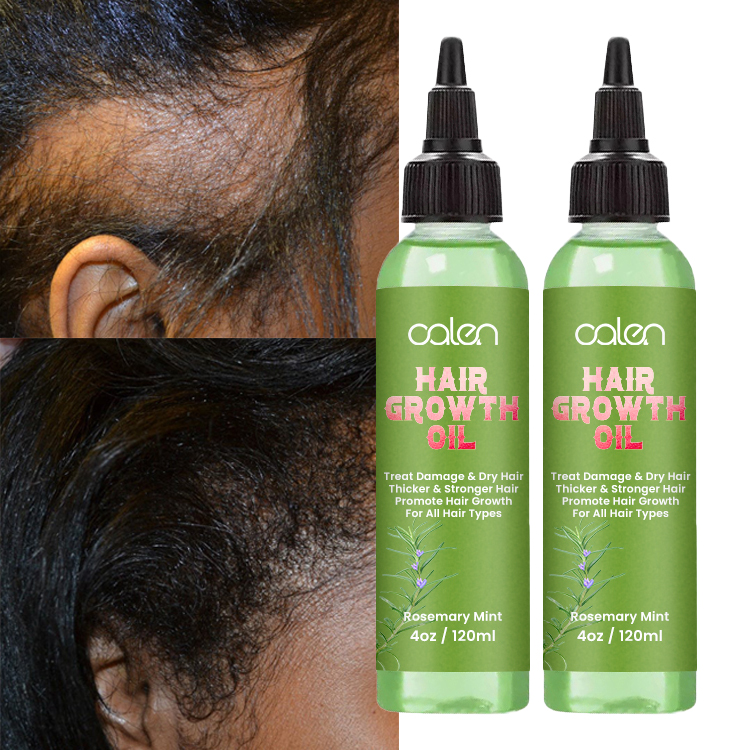 Oalen Уход за волосами способствовать росту волос Массажная питательный Saver снять головы напряжения Освежающая мята масло кожи