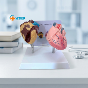 Modelo <span class=keywords><strong>de</strong></span> Anatomía <span class=keywords><strong>de</strong></span> Órganos Humanos para Comparar Corazones Patológicos y Sanos, <span class=keywords><strong>de</strong></span> Plástico, para Educación Médica, Yulin YL2-30079 - Product Image 1