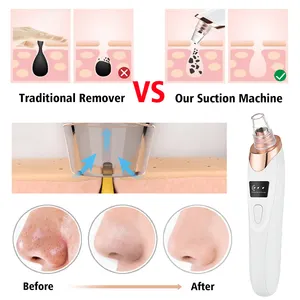 KKS beauty-limpiador de poros eléctrico recargable, productos para quitar espinillas al vacío