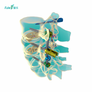 5.5 Titanyum <span class=keywords><strong>Spinal</strong></span> Vida Sistemi Ayarlanabilir Konnektör Ortopedik Omurga İmplantı - Product Image 5