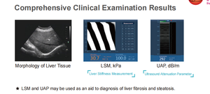 Système de diagnostic hépatique vétérinaire portable 2 en 1 DMGZCS03 : évaluation quantitative hépatique par ultrasons et examen par ultrasons - Product Image 5