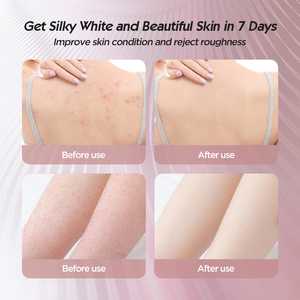 गोल सनफ्लावर शावर बॉल सुपर सॉफ्ट मसाज बाथ बॉल सक्शन कप ब्रश बाथ टॉवल मड स्पंज बाथरूम एक्सेसरीज के साथ - Product Image 6