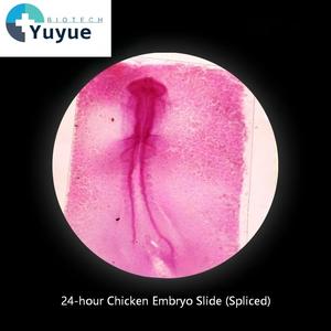 Portaobjetos de <span class=keywords><strong>microscopio</strong></span> preparado con embriones de pollo empalmados de 24 horas, para embrionología vertebrada, biología, ciencia educativa, accesorio de preparado. - Product Image 1
