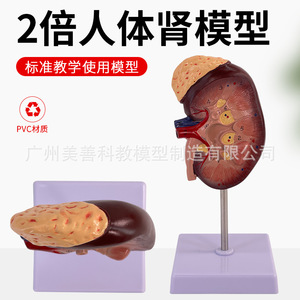 Modèle d'enseignement d'anatomie rénale grossi 2x, modèle réduit d'anatomie rénale humaine normale, avec glande surénalette - Product Image 3