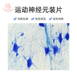 Motor neuron slide specimens, typical comprehensive categories, <b>microscope</b> slides, student gifts, <b>microscope</b> slides - Product Image 5