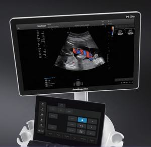 स्कैनर ट्रॉली गूफो अल्ट्रासाउंड मशीन/सोनोस्कैप पी 9 कुलीन 5 डी अल्ट्रासाउंड नैदानिक तनाव इको - Product Image 6