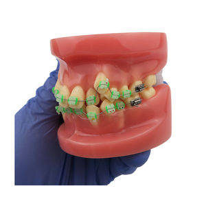 Modelo de Demostración de Ortodoncia para Educación Dental con 28 Piezas de Dientes y Brackets de Cerámica - Product Image 5