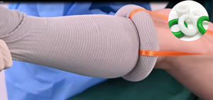 حلقة طبية سريعة لإيقاف النزيف للأصابع وأصابع القدم، أداة طوارئ يمكن التخلص منها، حلقة سيليكون طبية بالجملة، شحن خلال 7 أيام - Product Image 4