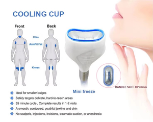 <span class=keywords><strong>Appareil</strong></span> de <span class=keywords><strong>cryolipolyse</strong></span> de qualité professionnelle pour amincissement et remodelage corporel par congélation des graisses - Product Image 6