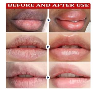 Nouveau <span class=keywords><strong>baume</strong></span> à lèvres supprimer foncé éclaircir mélanine masque à lèvres fondu ligne à lèvres éclaircir exfoliant hydrater réparation de la peau morte - Product Image 5