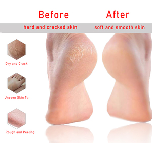 Vente de gros Éliminateur de peau morte Soins des pieds Patch hydratant pour la peau des pieds - Product Image 3