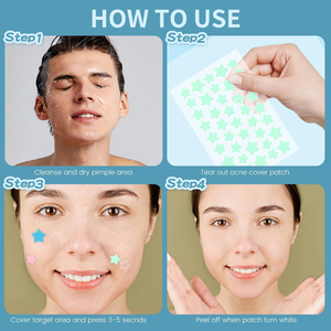 Patchs Hydrocolloïdes Colorés pour l'Acné – Soins de la Peau, Autocollants de Couverture pour Boutons et Imperfections - Product Image 2
