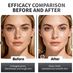 <span class=keywords><strong>Mascarilla</strong></span> Facial <span class=keywords><strong>de</strong></span> <span class=keywords><strong>Arcilla</strong></span> <span class=keywords><strong>de</strong></span> Té <span class=keywords><strong>Verde</strong></span>, <span class=keywords><strong>Precio</strong></span> <span class=keywords><strong>de</strong></span> Fábrica, OEM, Burbujas, Reparación Profunda, Limpieza Profunda, Cuidado <span class=keywords><strong>de</strong></span> la Piel, Iluminadora - Product Image 5