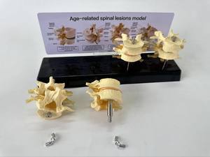 Vertebra lombare malata modello di ernia disco osteoporosi insegnamento ortopedico umano modello di comunicazione medico-paziente - Product Image 2