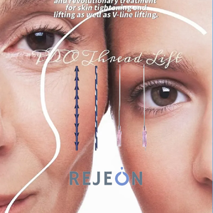 C Imageface 4D keskin iğne 20g 130mm 400mm PCL konu cilt kaldırma için Hilo Facials çift iğne vida dişli demir çubuk tipi